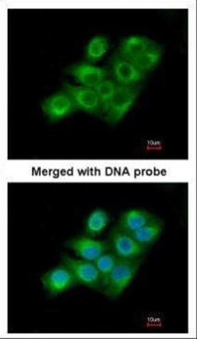 Factor XIII A Antibody in Immunocytochemistry (ICC/IF)