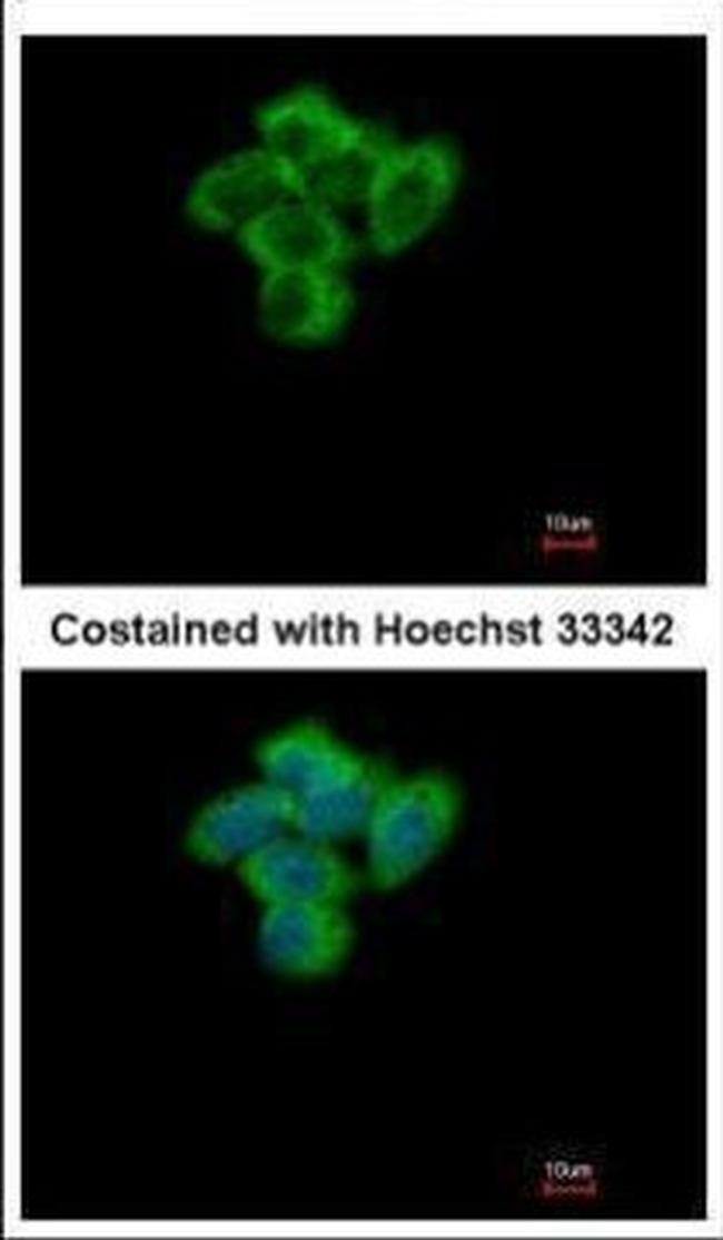 SENP2 Antibody in Immunocytochemistry (ICC/IF)