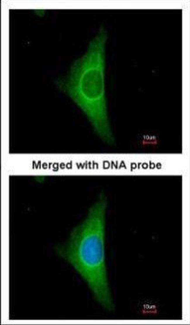 Cytokeratin 20 Antibody in Immunocytochemistry (ICC/IF)