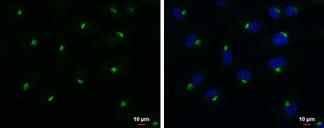 RAB6A Antibody in Immunocytochemistry (ICC/IF)