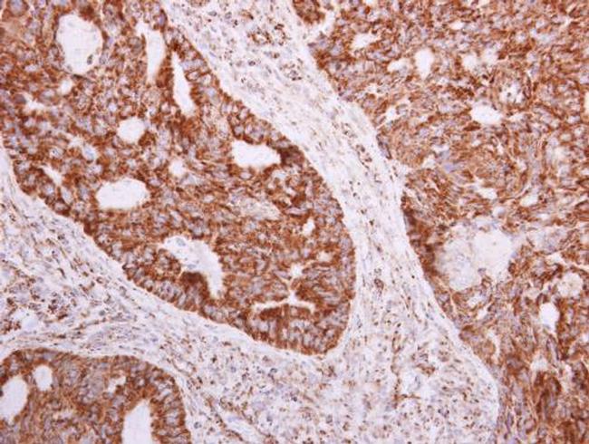 NDUFA5 Antibody in Immunohistochemistry (Paraffin) (IHC (P))