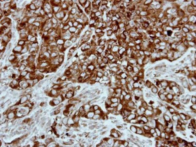 PPP3CB Antibody in Immunohistochemistry (Paraffin) (IHC (P))