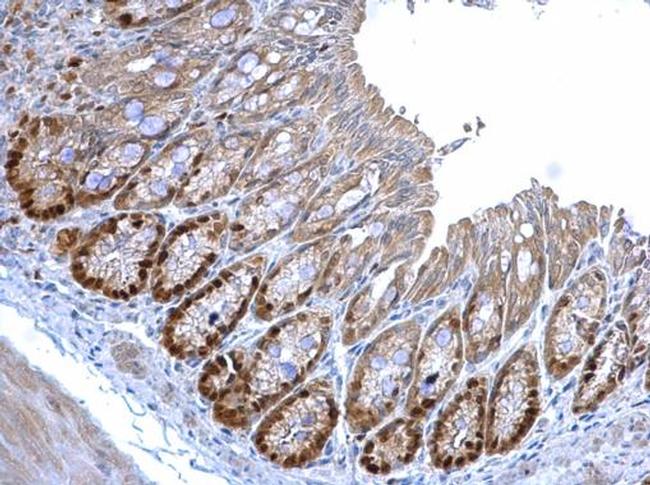 MCM3 Antibody in Immunohistochemistry (Paraffin) (IHC (P))