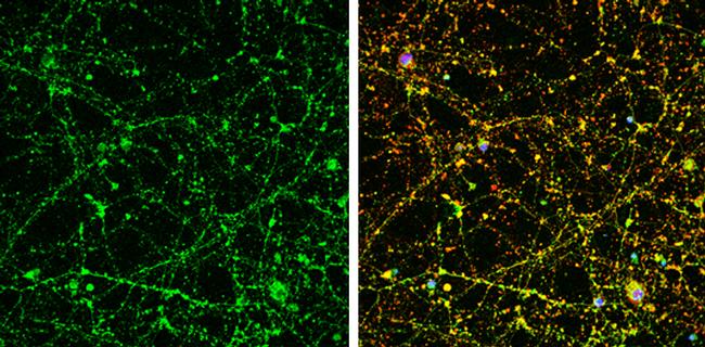 UNC13B Antibody in Immunocytochemistry (ICC/IF)