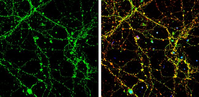 UNC13B Antibody in Immunocytochemistry (ICC/IF)