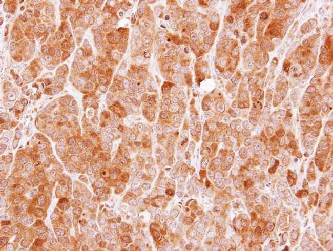 MVD Antibody in Immunohistochemistry (Paraffin) (IHC (P))