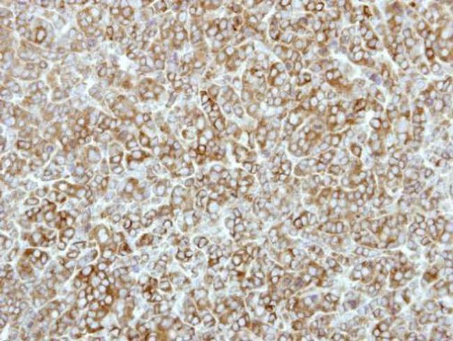 EEF2K Antibody in Immunohistochemistry (Paraffin) (IHC (P))