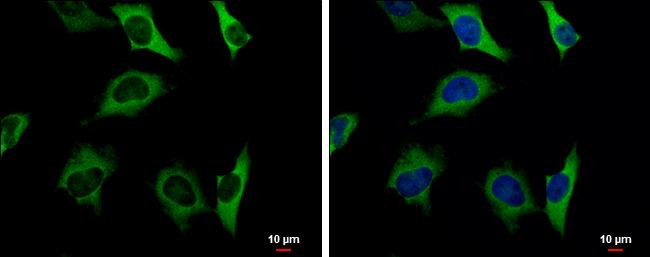 PKLR Antibody in Immunocytochemistry (ICC/IF)