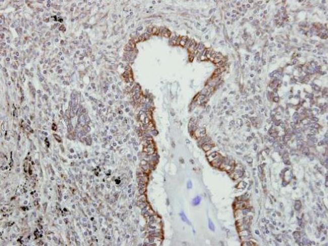 VAPA Antibody in Immunohistochemistry (Paraffin) (IHC (P))