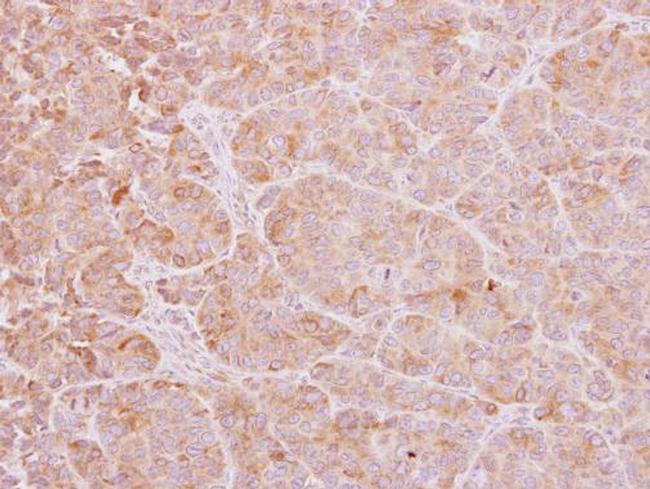 CHP1 Antibody in Immunohistochemistry (Paraffin) (IHC (P))