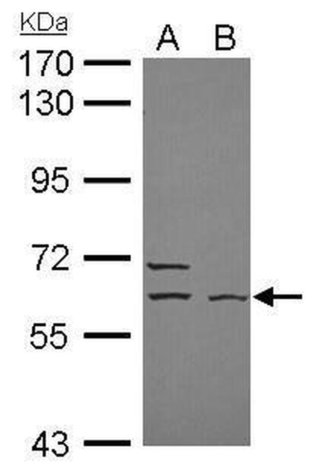 ELP3 Antibody in Western Blot (WB)