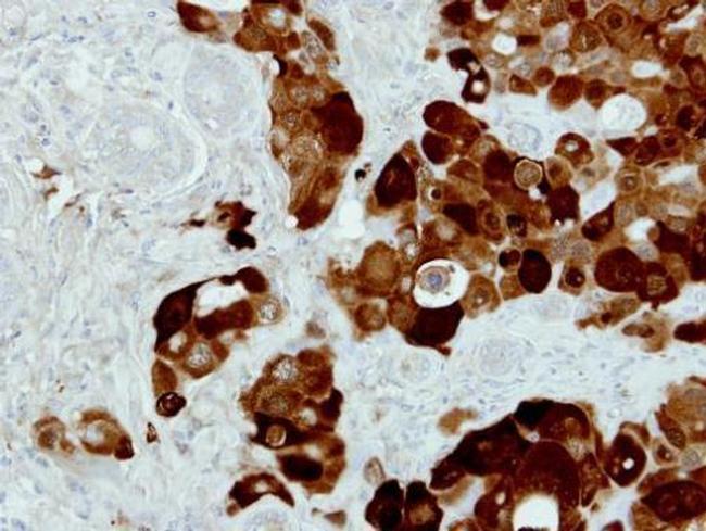 PIG3 Antibody in Immunohistochemistry (Paraffin) (IHC (P))