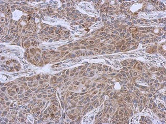 DLST Antibody in Immunohistochemistry (Paraffin) (IHC (P))