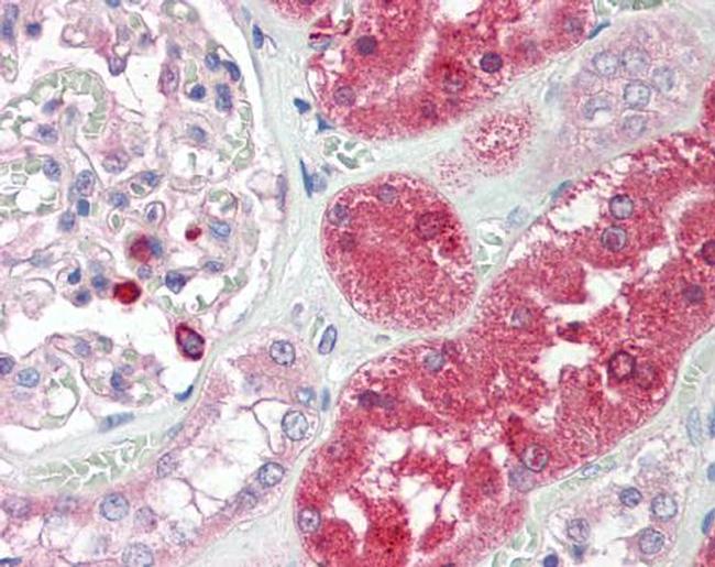 ENTPD5 Antibody in Immunohistochemistry (Paraffin) (IHC (P))