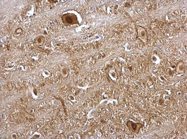 VCP Antibody in Immunohistochemistry (Paraffin) (IHC (P))