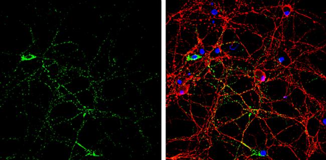 GAD65 Antibody in Immunocytochemistry (ICC/IF)