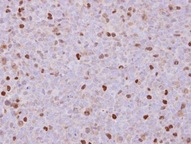 RACGAP1 Antibody in Immunohistochemistry (Paraffin) (IHC (P))