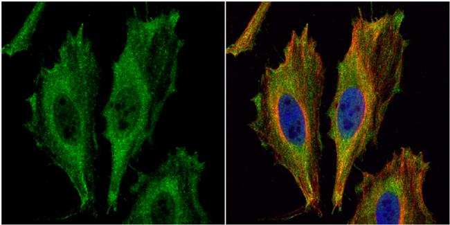 Aspartoacylase Antibody in Immunocytochemistry (ICC/IF)