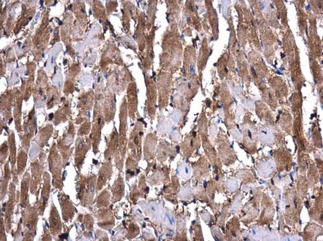 GSTM1 Antibody in Immunohistochemistry (Paraffin) (IHC (P))