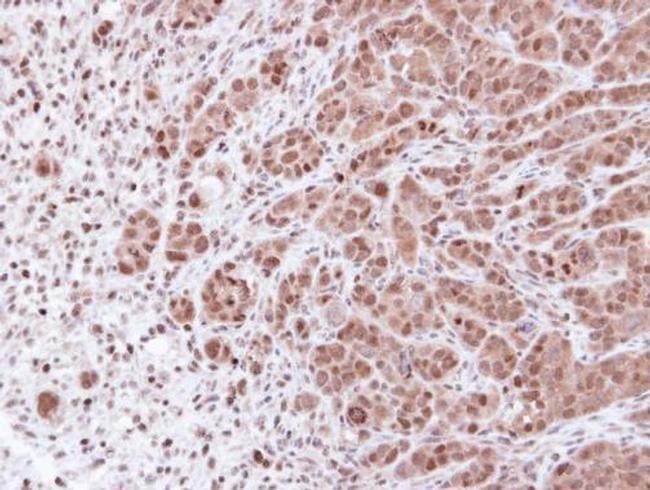 PSMA7 Antibody in Immunohistochemistry (Paraffin) (IHC (P))