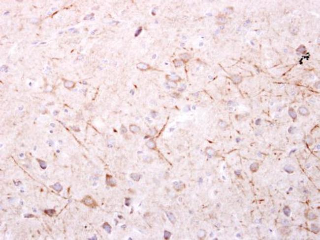 SPR Antibody in Immunohistochemistry (Paraffin) (IHC (P))