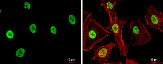 SAE1 Antibody in Immunocytochemistry (ICC/IF)