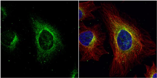 ASL Antibody in Immunocytochemistry (ICC/IF)