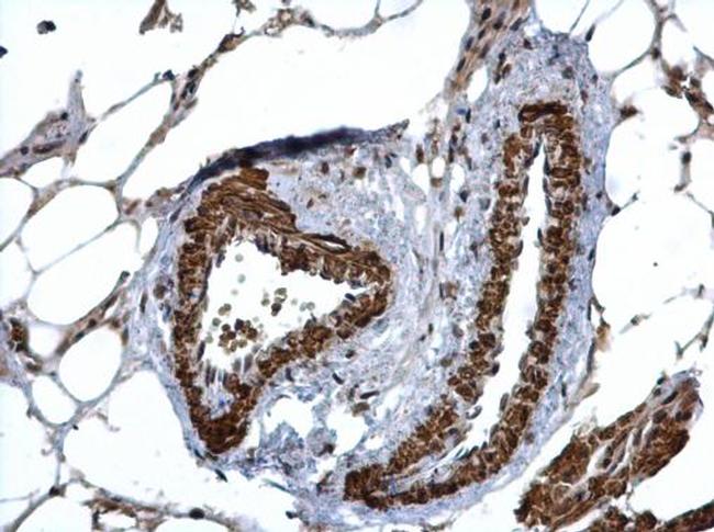 HUS1 Antibody in Immunohistochemistry (Paraffin) (IHC (P))