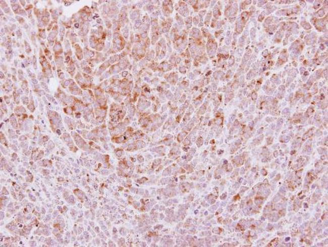 Laminin gamma-2 Antibody in Immunohistochemistry (Paraffin) (IHC (P))