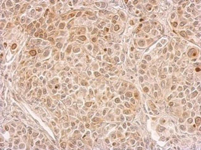 CIAPIN1 Antibody in Immunohistochemistry (Paraffin) (IHC (P))