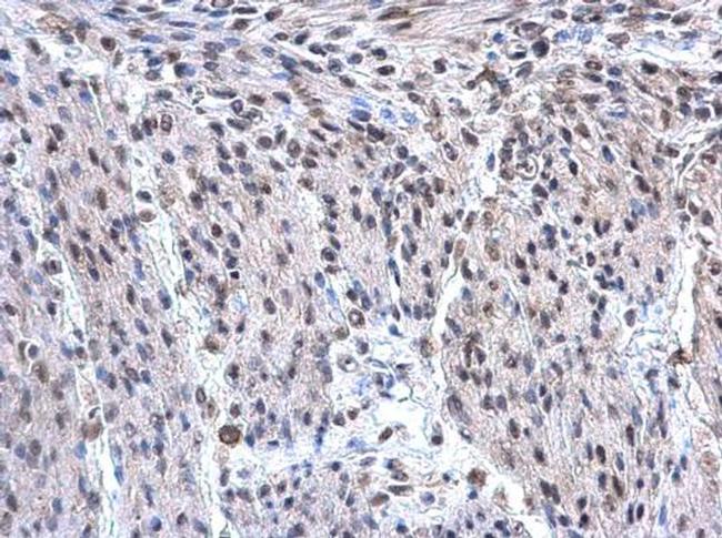 hnRNP F Antibody in Immunohistochemistry (Paraffin) (IHC (P))