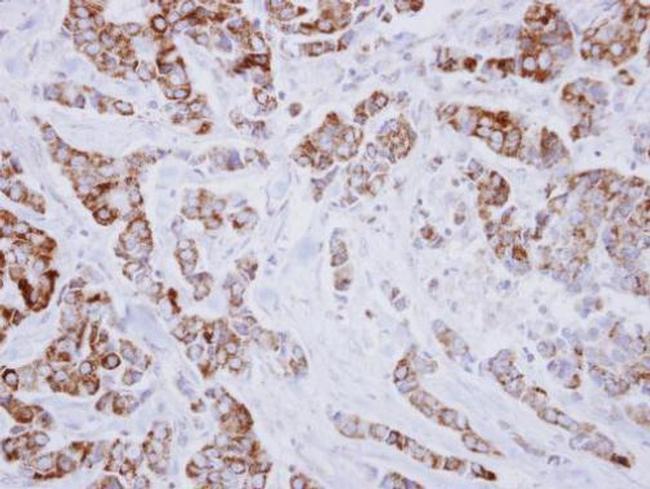 IVD Antibody in Immunohistochemistry (Paraffin) (IHC (P))