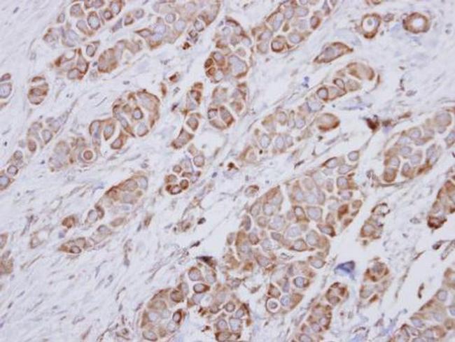 NDUFA10 Antibody in Immunohistochemistry (Paraffin) (IHC (P))