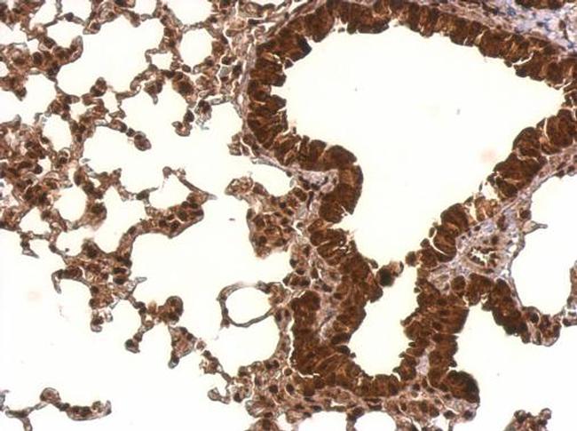 PCBP2 Antibody in Immunohistochemistry (Paraffin) (IHC (P))