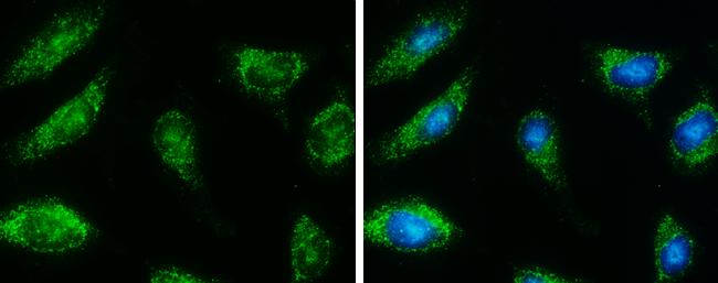 HSD17B4 Antibody in Immunocytochemistry (ICC/IF)