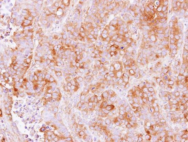 TMED2 Antibody in Immunohistochemistry (Paraffin) (IHC (P))