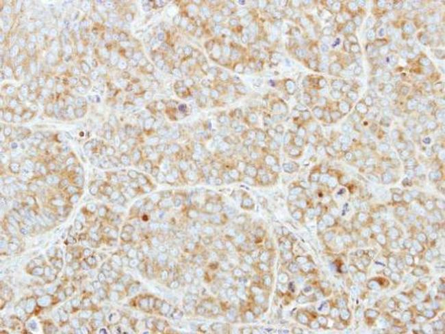 CSDE1 Antibody in Immunohistochemistry (Paraffin) (IHC (P))