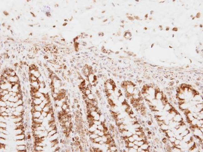 PNPase Antibody in Immunohistochemistry (Paraffin) (IHC (P))