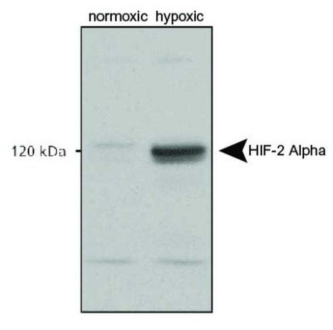 HIF-2 alpha Antibody in Western Blot (WB)