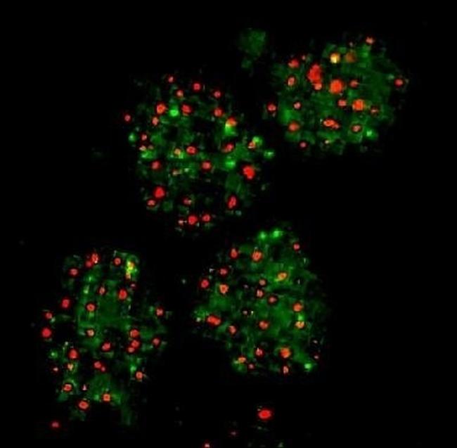 FANCD2 Antibody in Immunocytochemistry (ICC/IF)