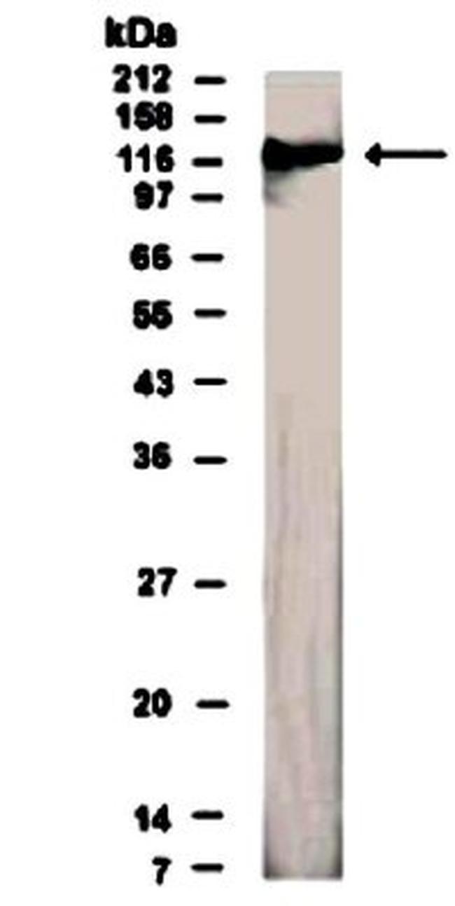 CD100 Antibody in Western Blot (WB)