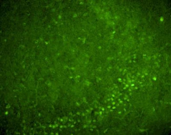 Nurr1 Antibody in Immunohistochemistry (PFA fixed) (IHC (PFA))