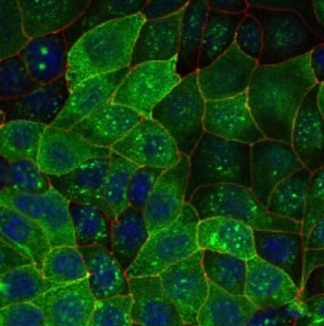 Aquaporin 2 Antibody in Immunocytochemistry (ICC/IF)