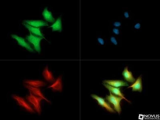 FER Antibody in Immunocytochemistry (ICC/IF)