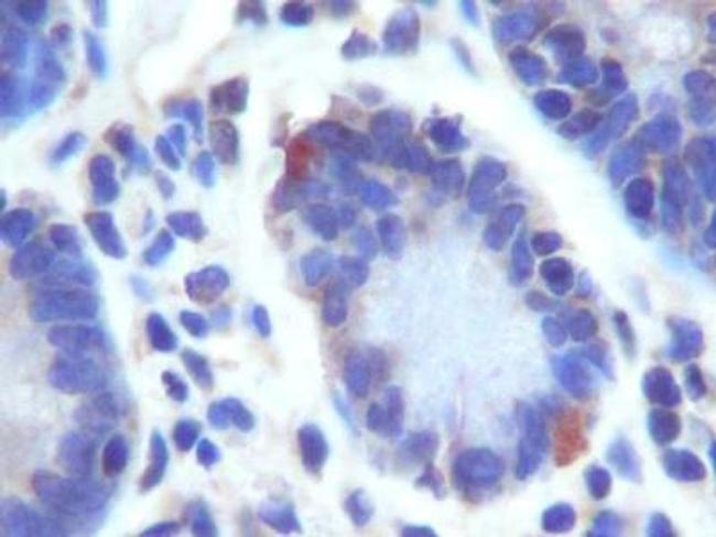 LGR5 Antibody in Immunohistochemistry (Paraffin) (IHC (P))