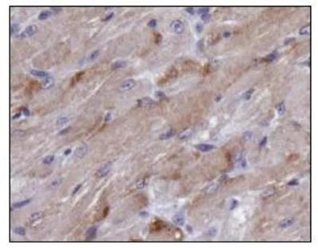 TIGAR Antibody in Immunohistochemistry (Paraffin) (IHC (P))