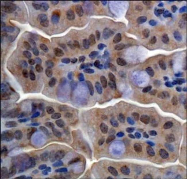 RBBP6 Antibody in Immunohistochemistry (Paraffin) (IHC (P))