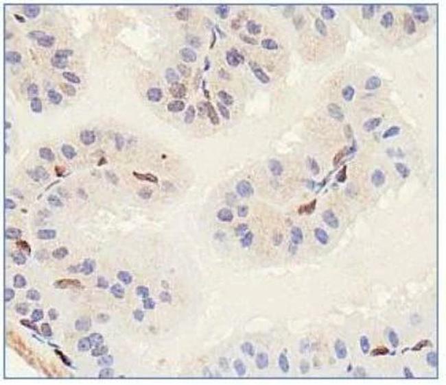 SLITRK1 Antibody in Immunohistochemistry (IHC)