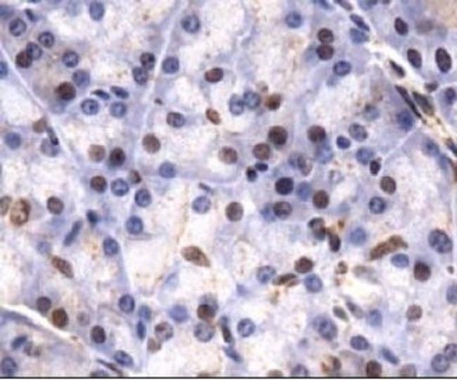 JMJD2C Antibody in Immunohistochemistry (Paraffin) (IHC (P))