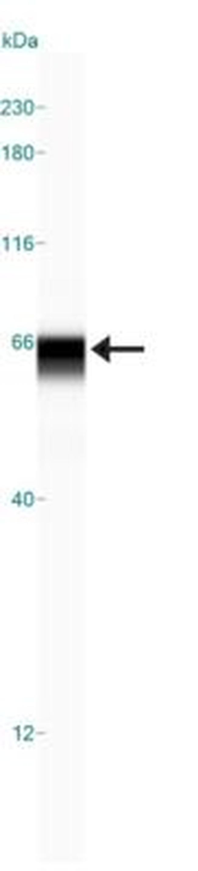 USP22 Antibody in Western Blot (WB)